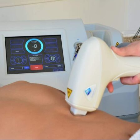 Depilación Laser Diodo