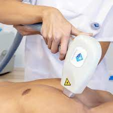 Depilacion Laser